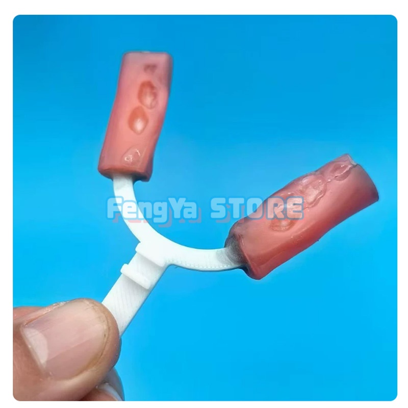 10Pcs/Bag Alat Bantu Ortodonti - 3D Printing Orthodontics ulasan dan harga